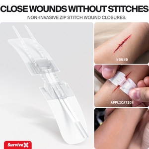 Zip Stitch Wound Closure Kit