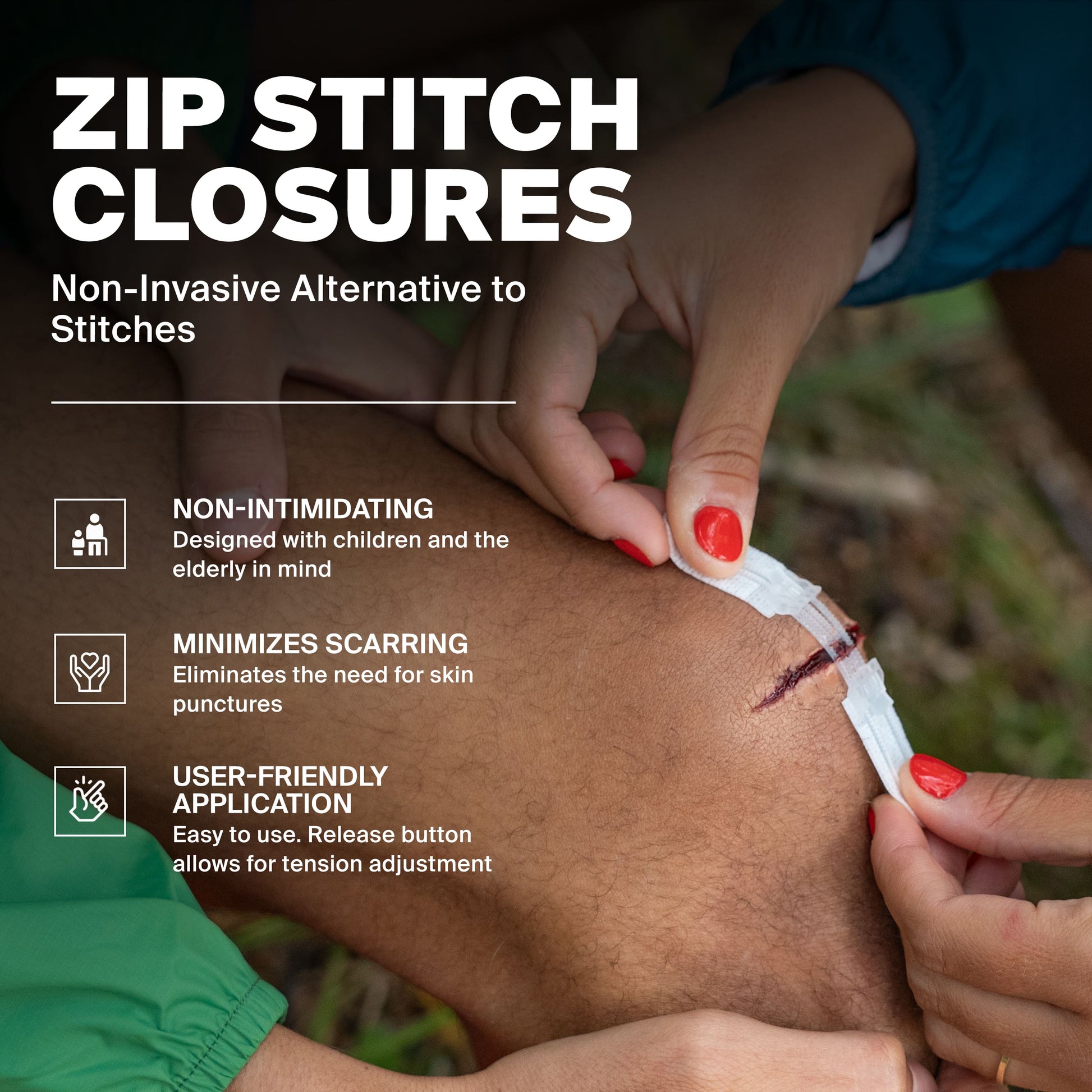 Survivex Zip Stitch Wound Closure Kit - Non-Invasive Alternative To Stitches