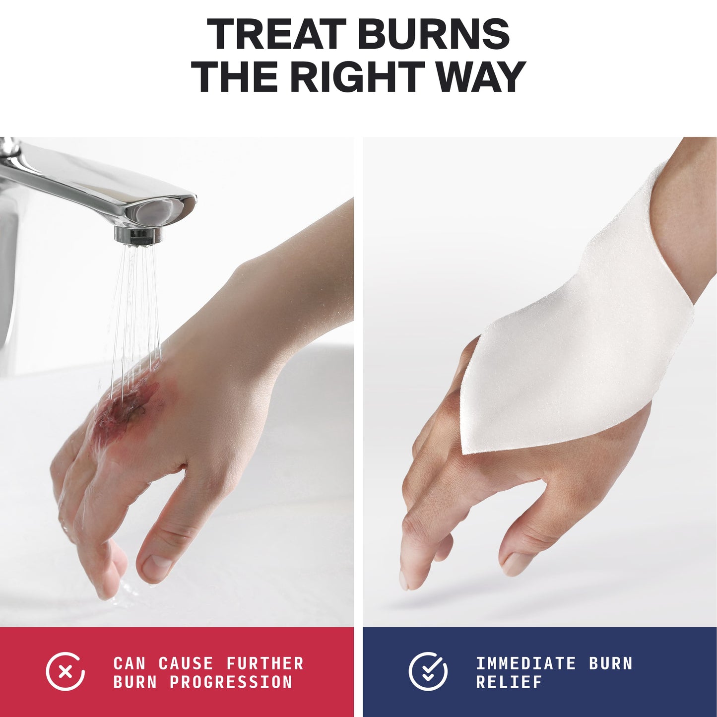 SurviveX Hydrogel Burn Dressings 5-pack - Treat Burns The Right Way