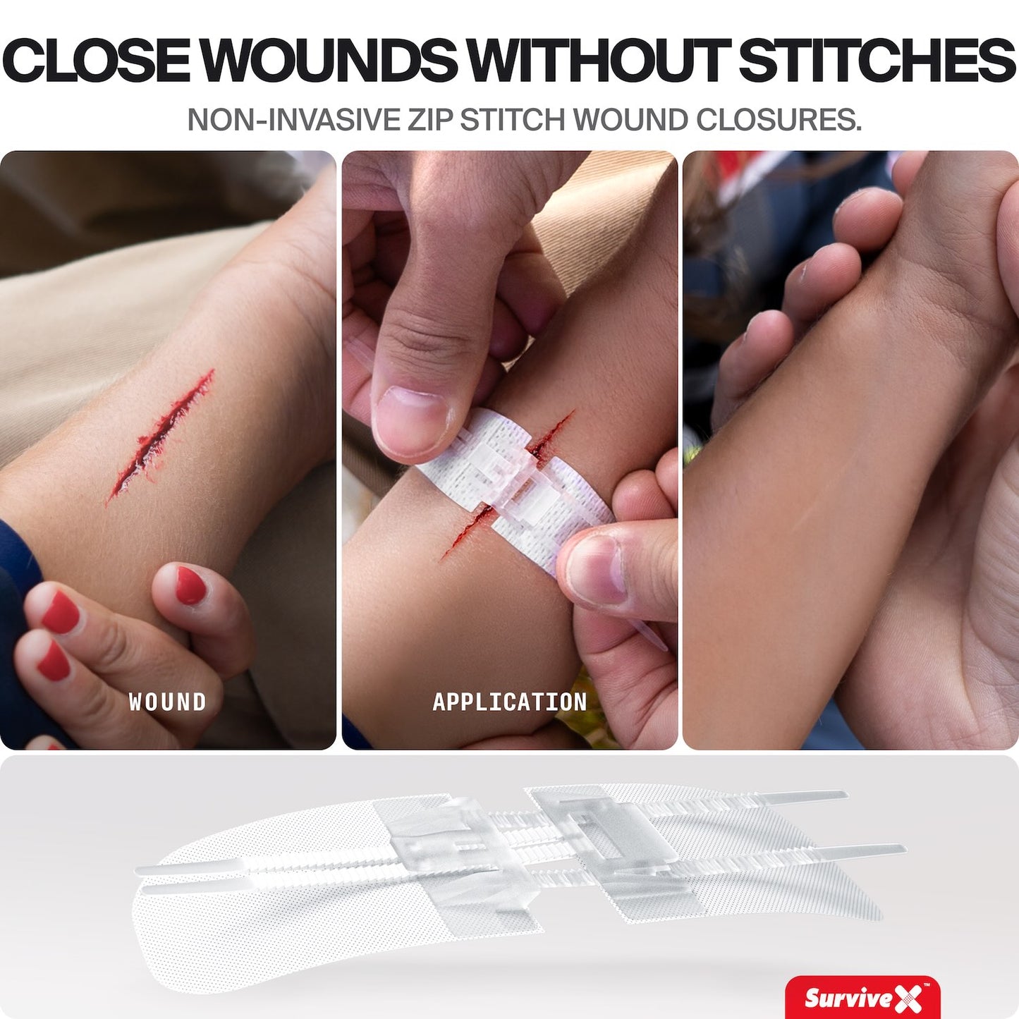 Three-panel demonstration showing a wound closure product in use on a child's arm, with labeled steps: WOUND, APPLICATION, and closed wound. The top text reads 'CLOSE WOUNDS WITHOUT STITCHES' and 'NON-INVASIVE ZIP STITCH WOUND CLOSURES.