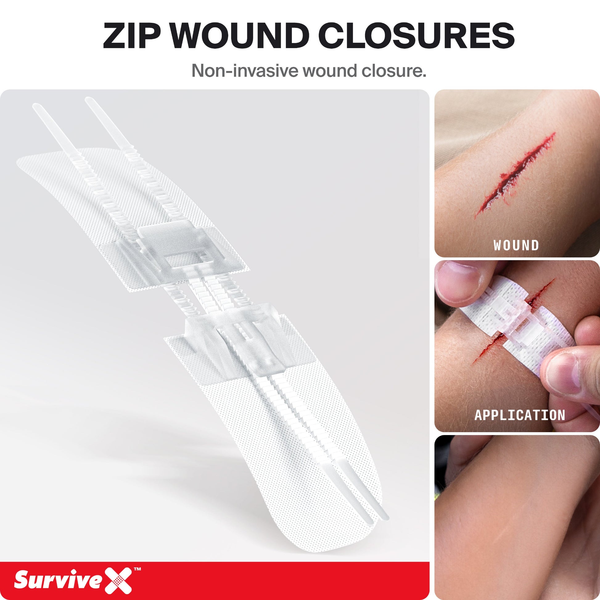 SurviveX Zip Wound Closures Non-Invasive